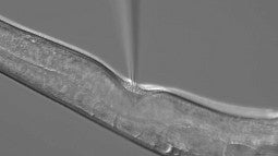 Injecting genetic material into C. elegans worm