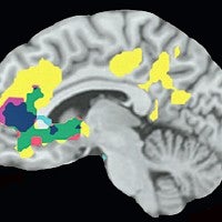 Image shows where in brain age, psychological and giving choices merge