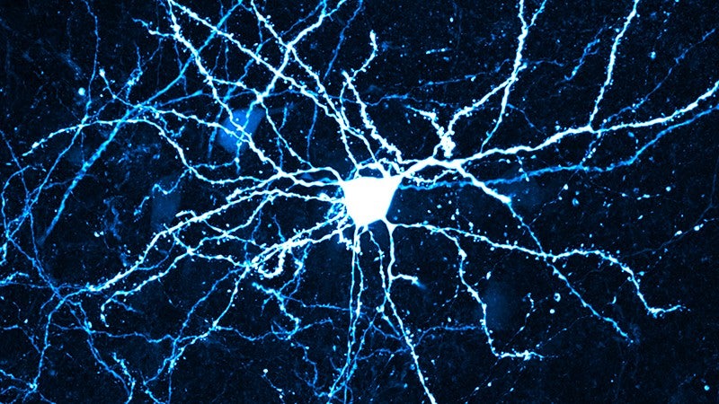Cortical neuron micrograph
