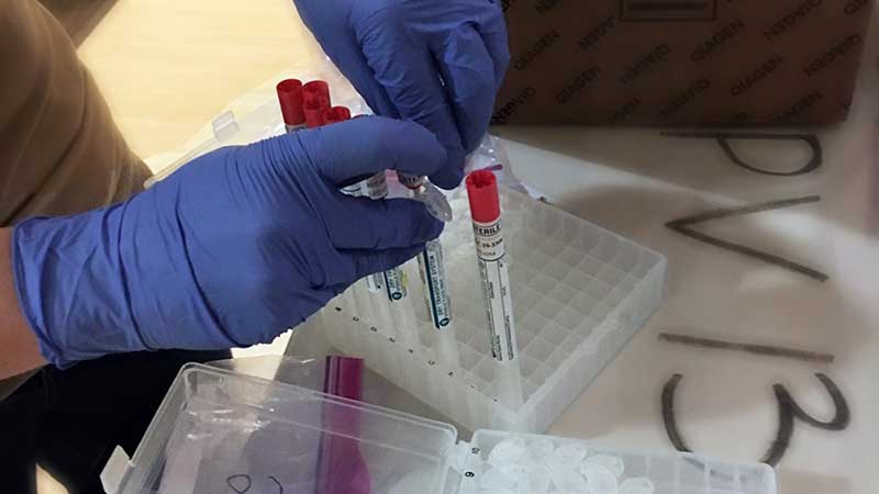 Lab worker preparing samples