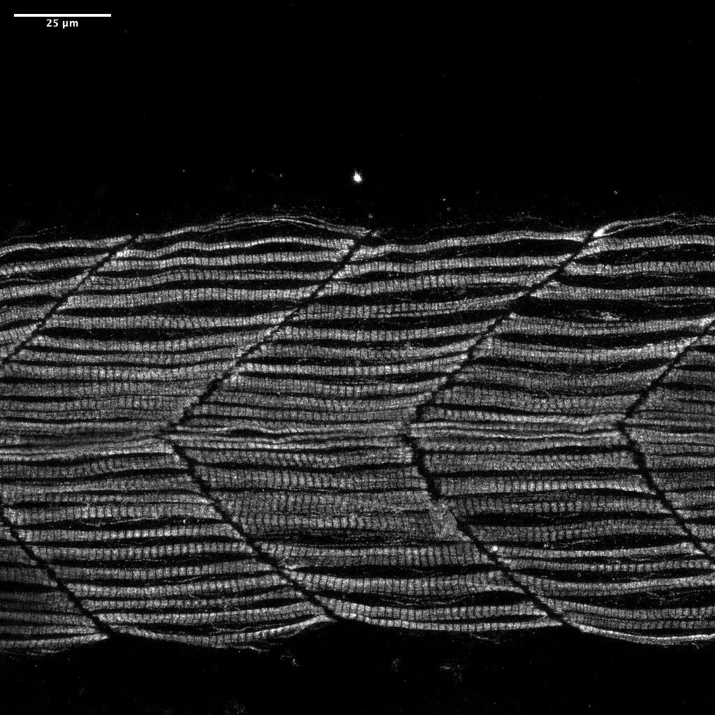 Muscle fibers in a healthy zebrafish