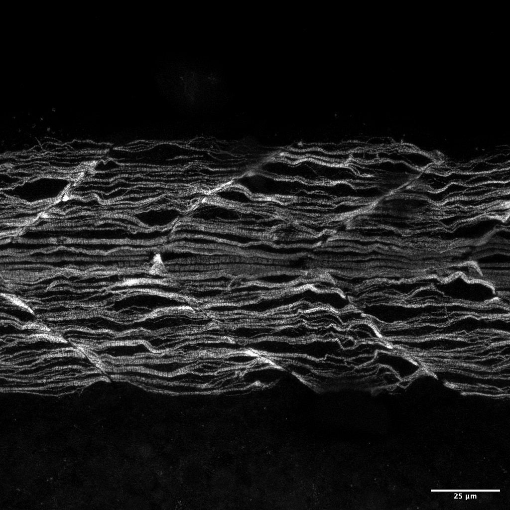 Abnormal muscle fibers in a zebrafish