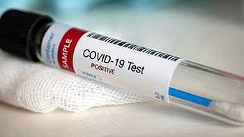 Test tube with COVID-19 test written on it