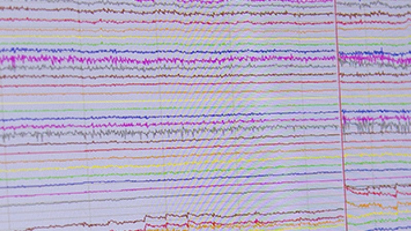 EEG recordings displayed on computer