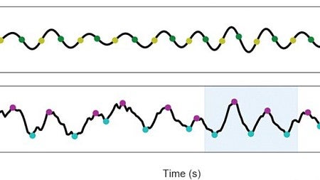 Raw unfiltered data, bottom, shows the sharper, steeper peaks of brain waves not detectable in filtered EEG data