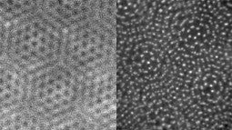 Before and after images using new microscopic technique
