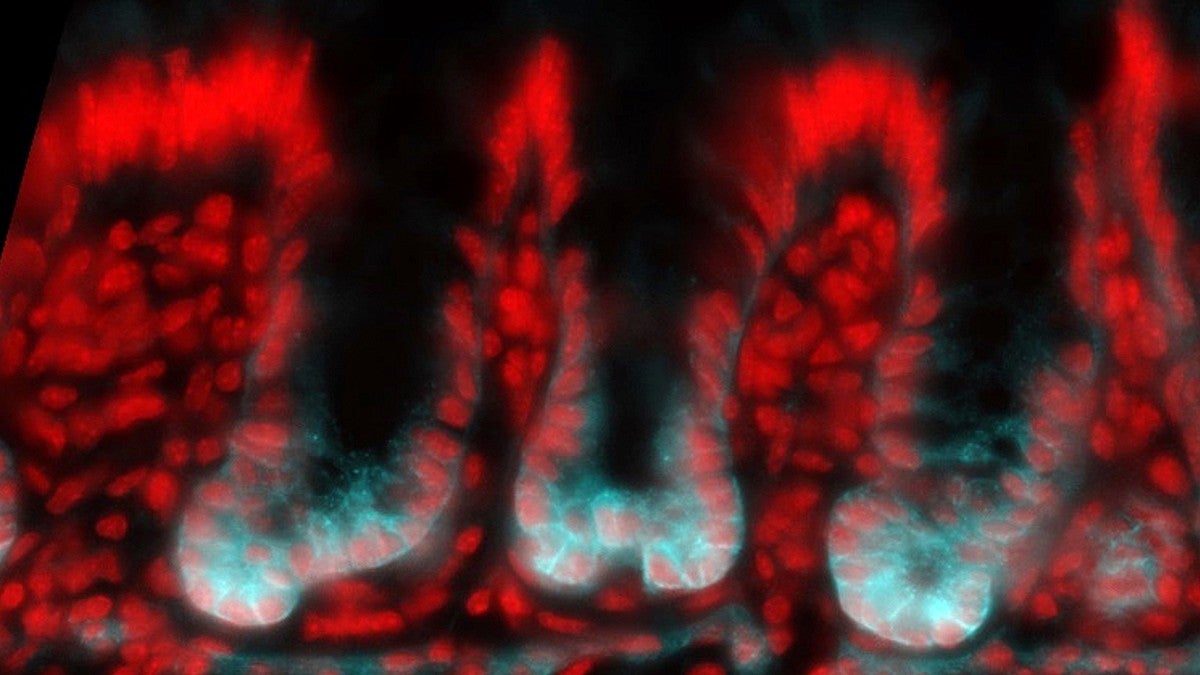 Epifluorescence image of the developing mouse colon