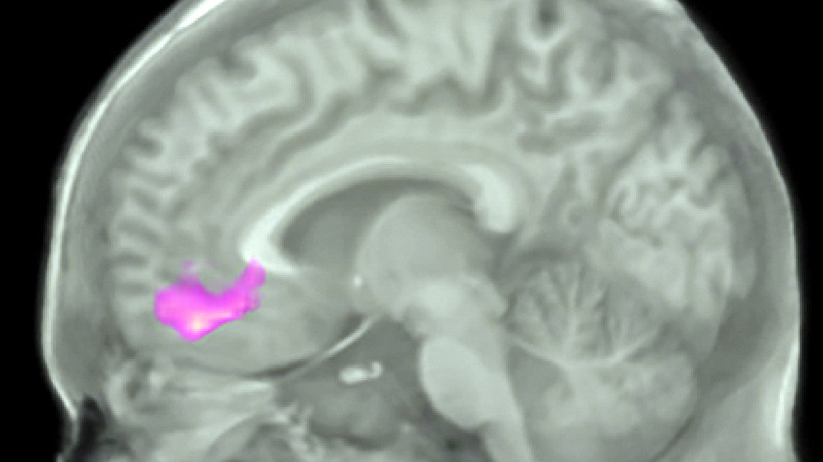 fMRI brain image shows region of the brain where altruism increased after writing about gratitude