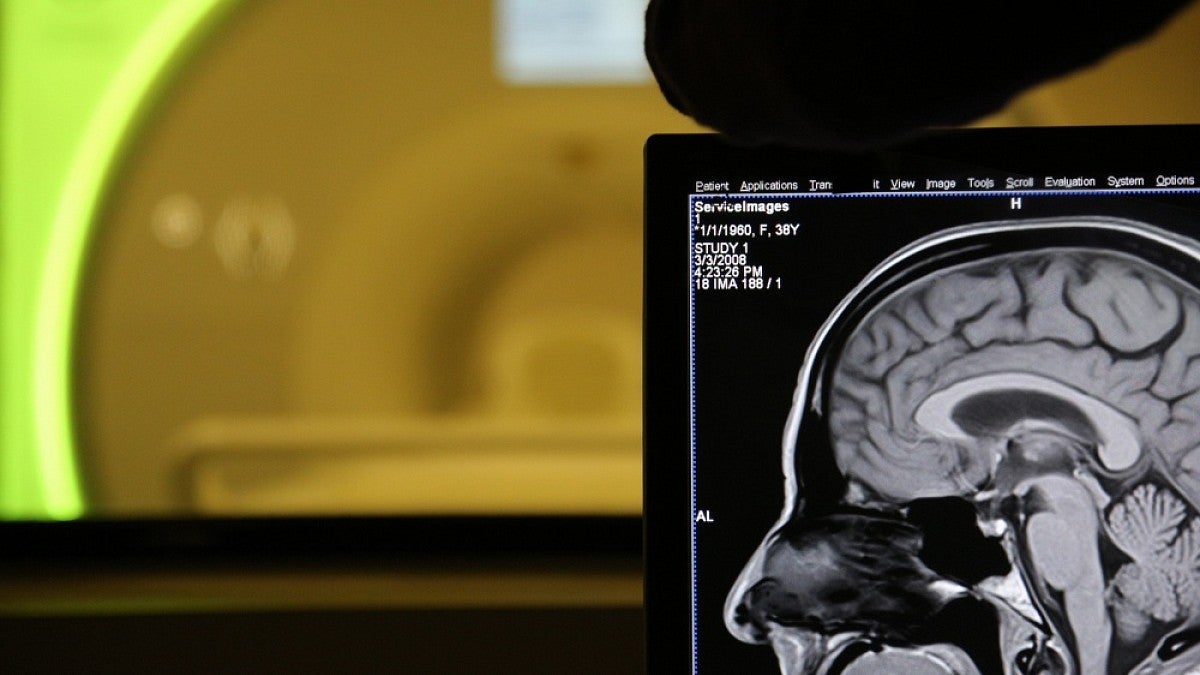 MRI device and brain scan