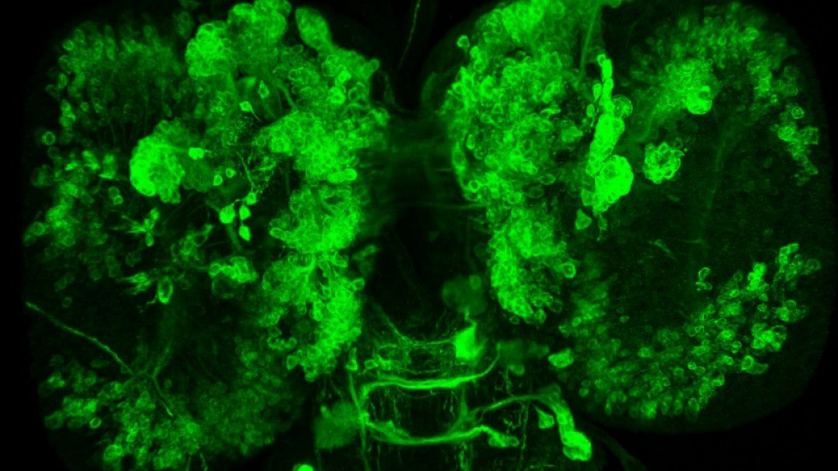 A proliferating mass of cells fills a Drosophila larval brain in absence of the protein Eyeless 