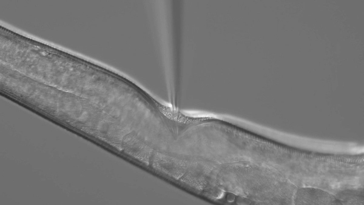 Injecting genetic material into C. elegans worm